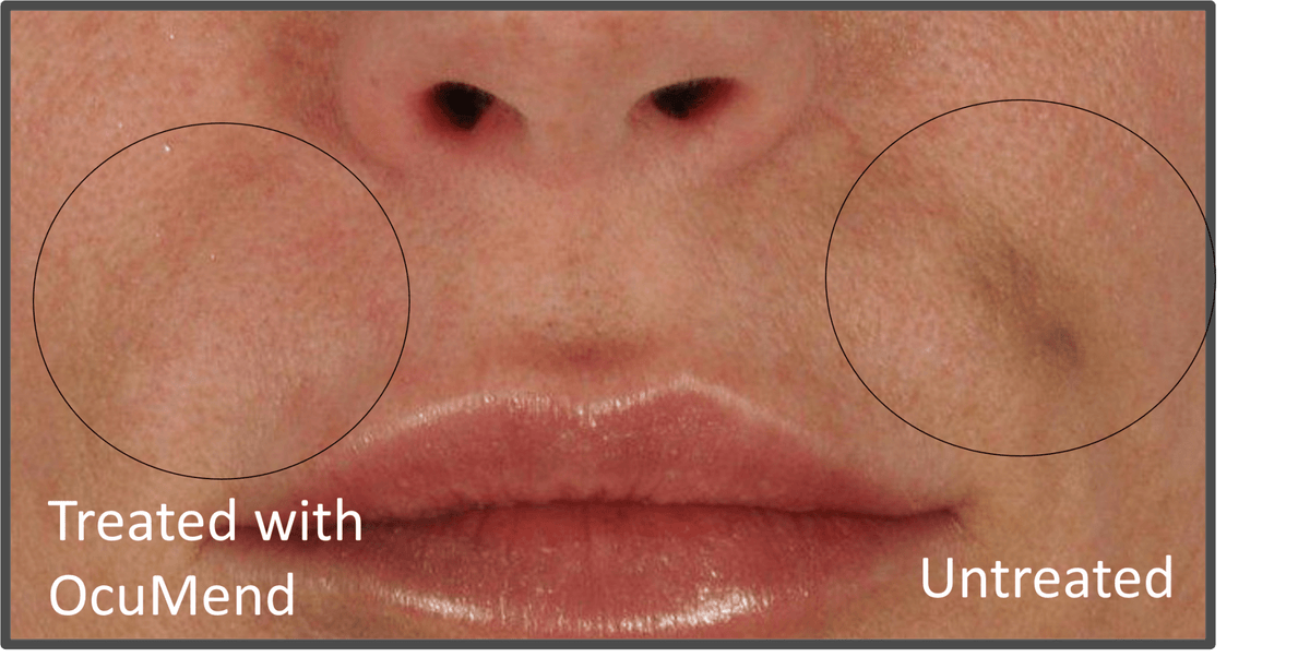 ActivMend from the Inventors of OcuMend - ActivMend