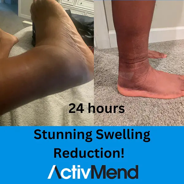 Activmend Gel Patch