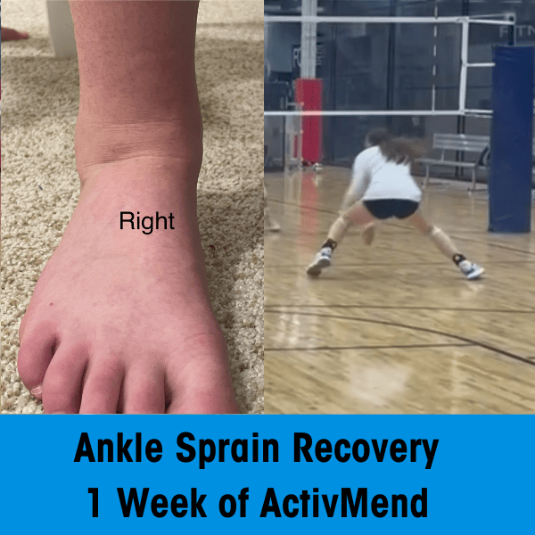 Paying volleyball in 1 week after using ActivMend