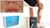 ActivMend replacement for OcuMend - ActivMend