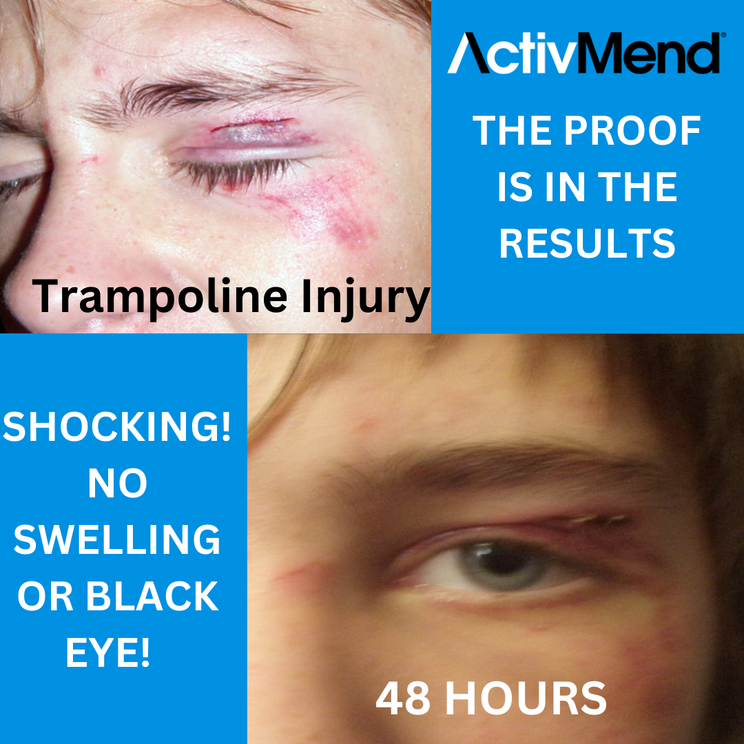 ActivMend 5 - Gel Patches