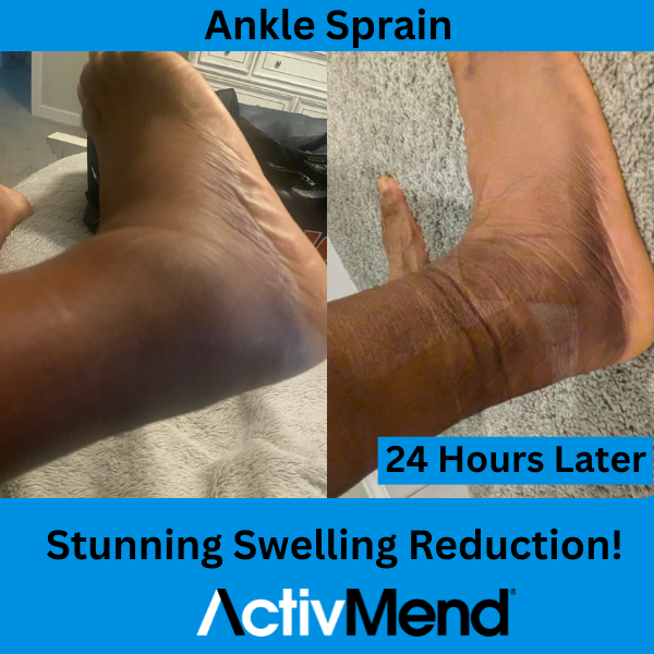 ActivMend 5 - Gel Patches